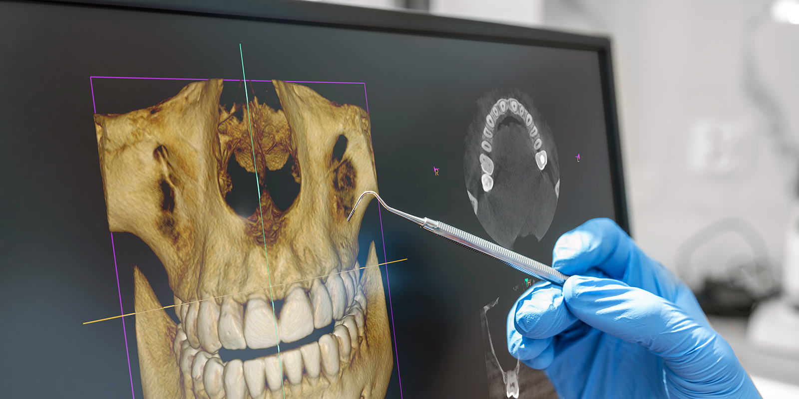 3D Röntgendiagnostik bei Hamadeh KFO-Praxis in Hennef